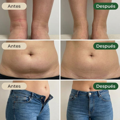 Pack 4 Meses SelaWell | Gotas para el Vientre Inflamado y Líquido Retenido Postparto
