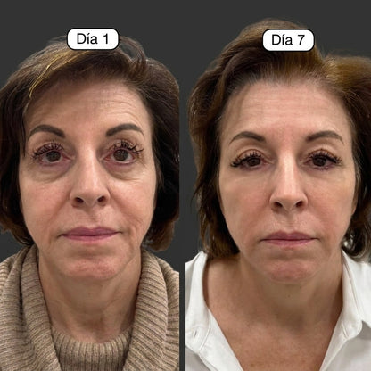 SelaWell | Spazzola facciale per massaggi di drenaggio linfatico